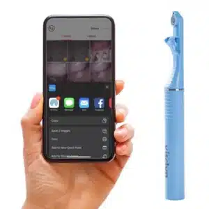 visclyn Smart Intraoral Camera